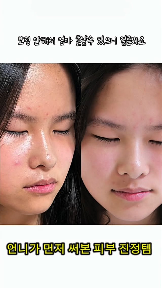 ra_mi30 게시물 이미지: #광고 

첫째 유독 심할 때 썼던 피부 진정템 

둘째는 “난 괜찮아 걱정 없어”...