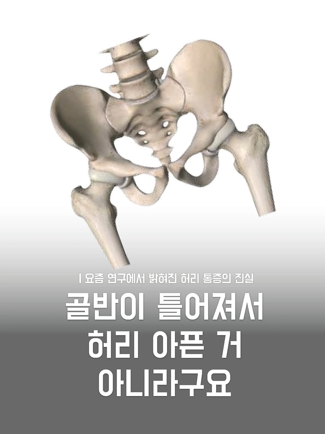 re._.building 게시물 이미지: 교차증후군, 맞을까? 틀릴까?
 
 
허리나 목이 아플 때,
“자세가 틀어져서...