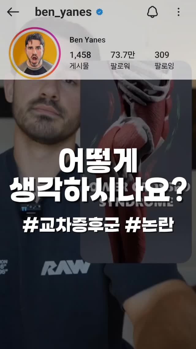 re._.building 게시물 이미지: 얀다님의 교차증후군, 어떻게 생각하세요?

위 영상은 원본 내용을 의역한...