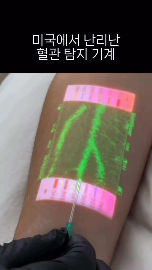 reading_nurse 게시물 이미지: IV 게이지까지 알려주는 혈관 탐지기계가 있다면 어떨거...