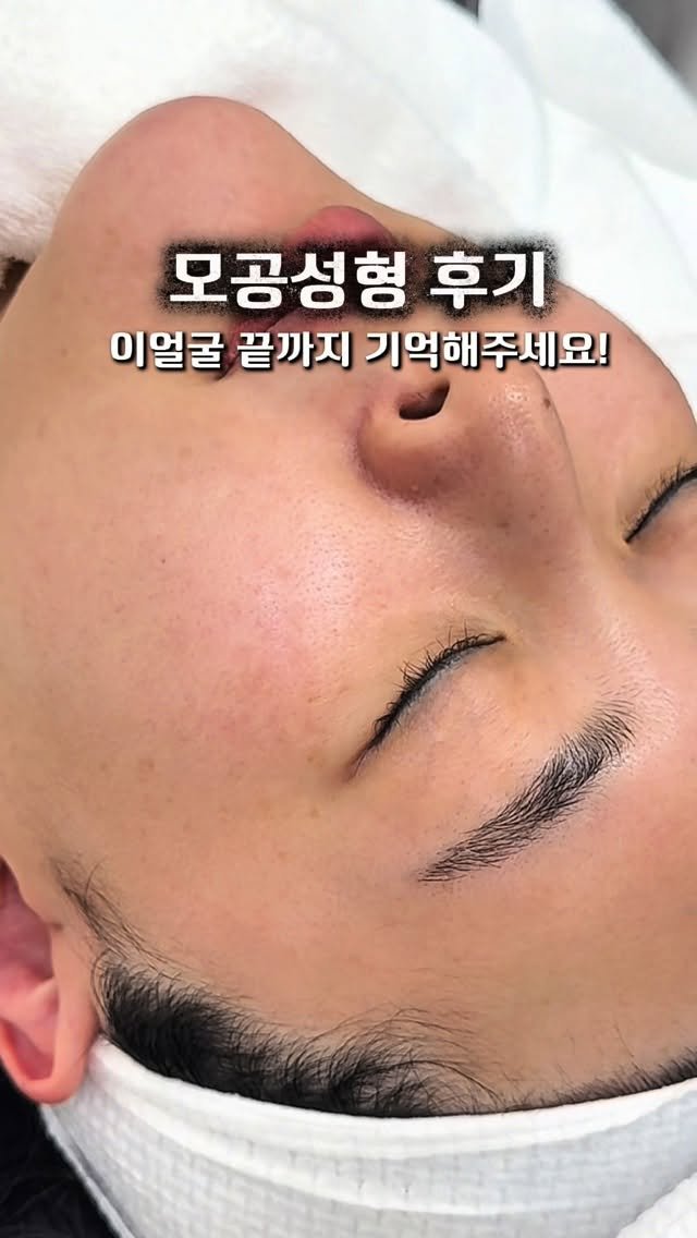regain.skinrap 게시물 이미지: 엑소좀 모공성형 #슈퍼젝션

이제는 너무 유명해져서
먼 타지, 해외에서도 일부러...