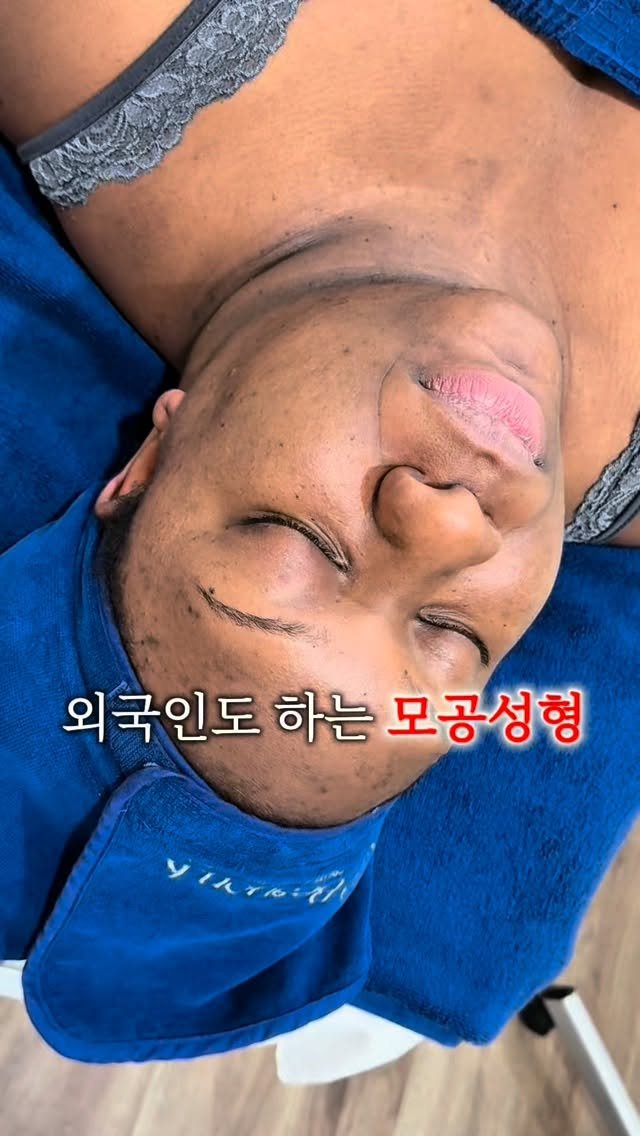 regain.skinrap 게시물 이미지: 전국에서 찾아오는 슈퍼젝션
이제는 해외에서도 찾아오실 만큼 사랑받고...