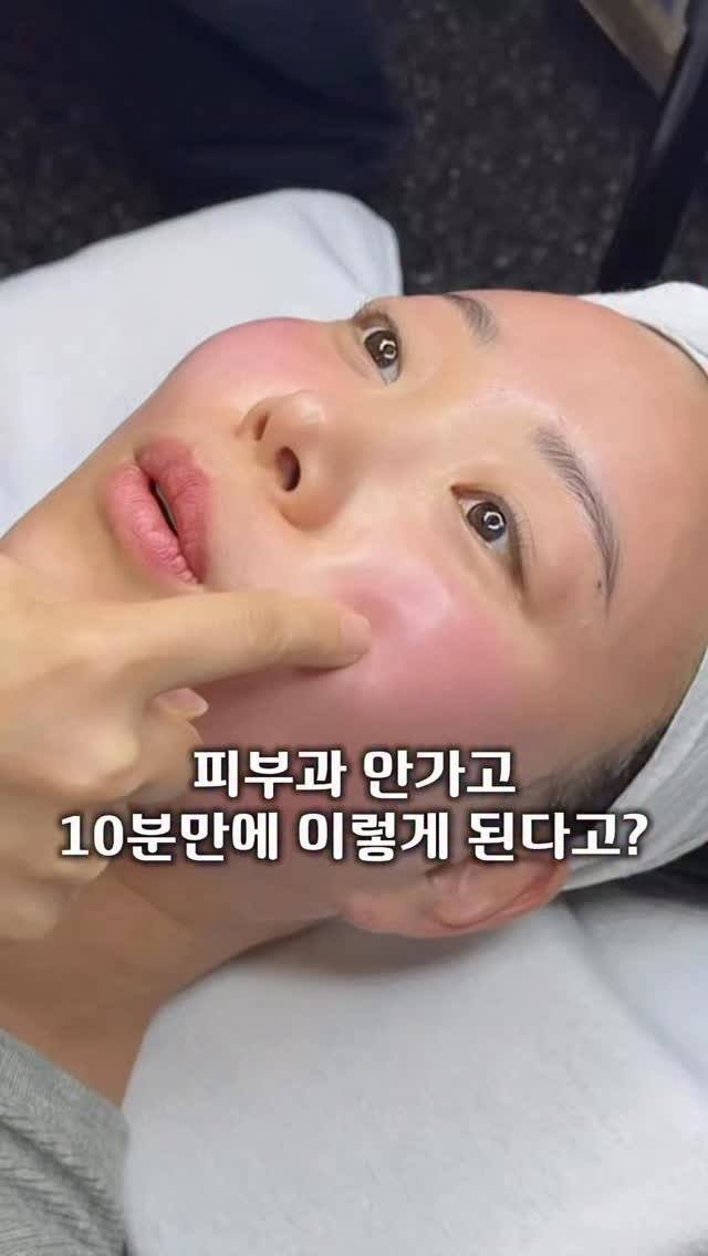 regain.skinrap 게시물 이미지: 문의 폭주 🔥🔥🔥🔥
3월 슈퍼젝션 대기자리 얼마 안남았어요!

타지역, 해외에서도...