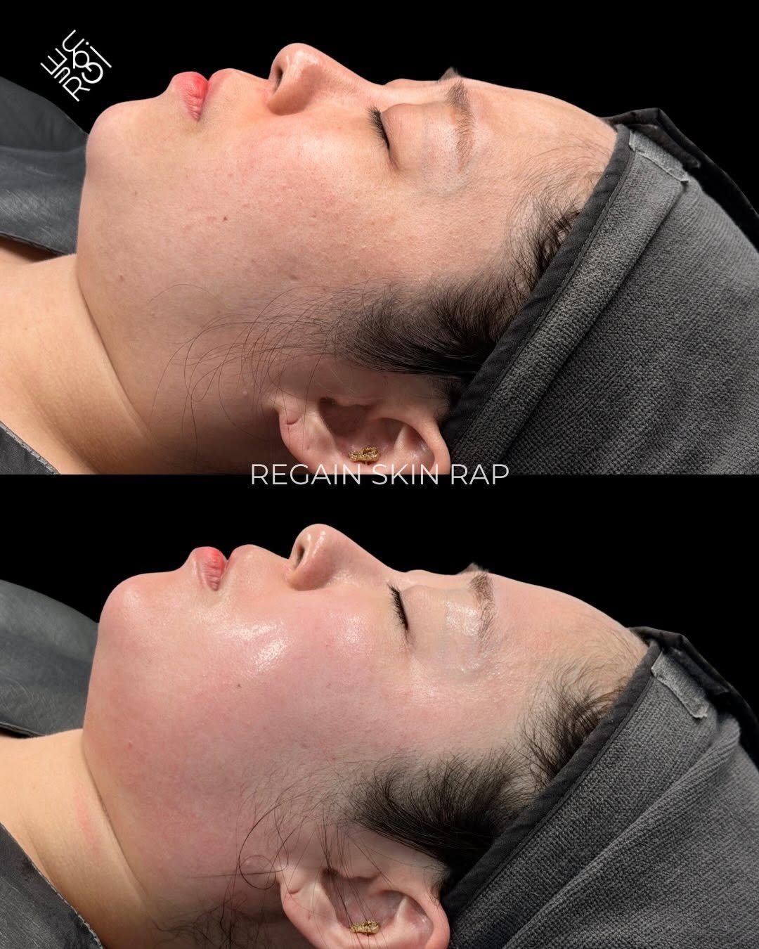 Photo shared by 슈퍼젝션 1위 | 2년 연속 최다 시술 수상 | 피부박사 피부관리 | (주) 리겐모어 대표 이승연 on December 01, 2025 tagging @regain.official, and @regain.skinrap. May be an image of one or more people and text that says 'চইি HAE REGAIN REGAINSKINRAP SKIN RAP'.