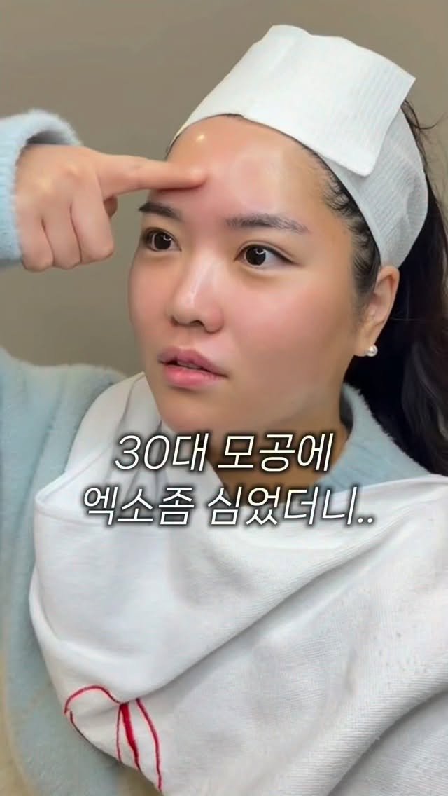 regain.skinrap 게시물 이미지: 피부과 시술 실패하고
리겐스킨랩을 찾아주신 리브님

피부과에 1000만원...