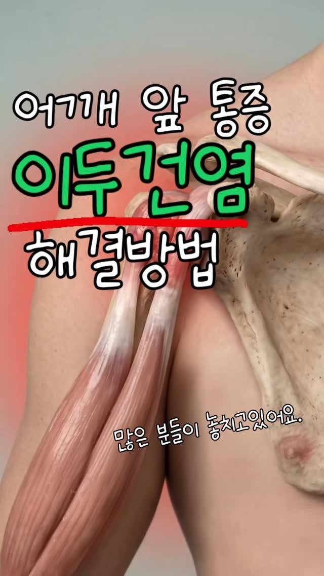 rehab.shouldeok 게시물 이미지: 앞쪽 어깨 통증이나 계속 반복된다면
단순히 근육 힘줄 찝힘 문제가...