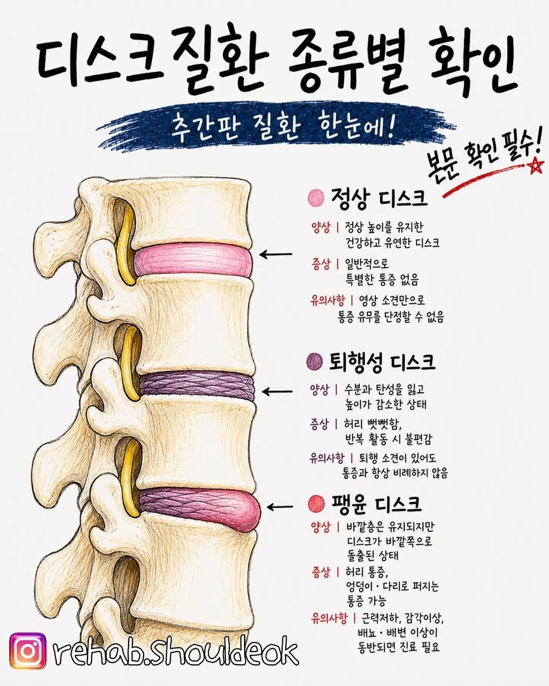 rehab.shouldeok 게시물 이미지: ⚡️디스크 질환을 볼 때 생각보다 많은 분들이 먼저
운동해도 되나요, 허리 구부려도...
