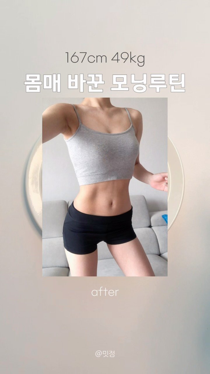 remeet_jeong 게시물 이미지: before는 20대때 몹쓸 눈바디,,최대한 작게👀 
40대 애엄마인 지금이 더...