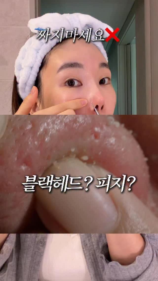rim.on__ 게시물 이미지: 코 피지 제발 짜지마세요❌ 큰 모공 줄어드는 3단계 공식 

블랙헤드, 피지, 피지...