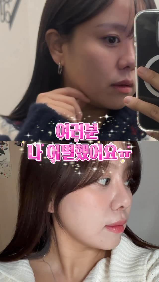 ririroooom 게시물 이미지: 이중턱.미운살과 이별한 리얼 후기..👀 ‘이중턱’ 써줌 바로 정보공유 메세지...