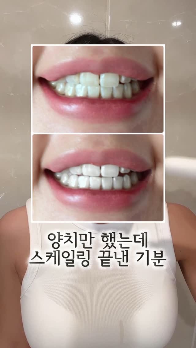 rudaya_nolja 게시물 이미지: #광고
집에서 매일하는 스켈링 어때요?🫢
양치를 햇는데도 입 냄새가...