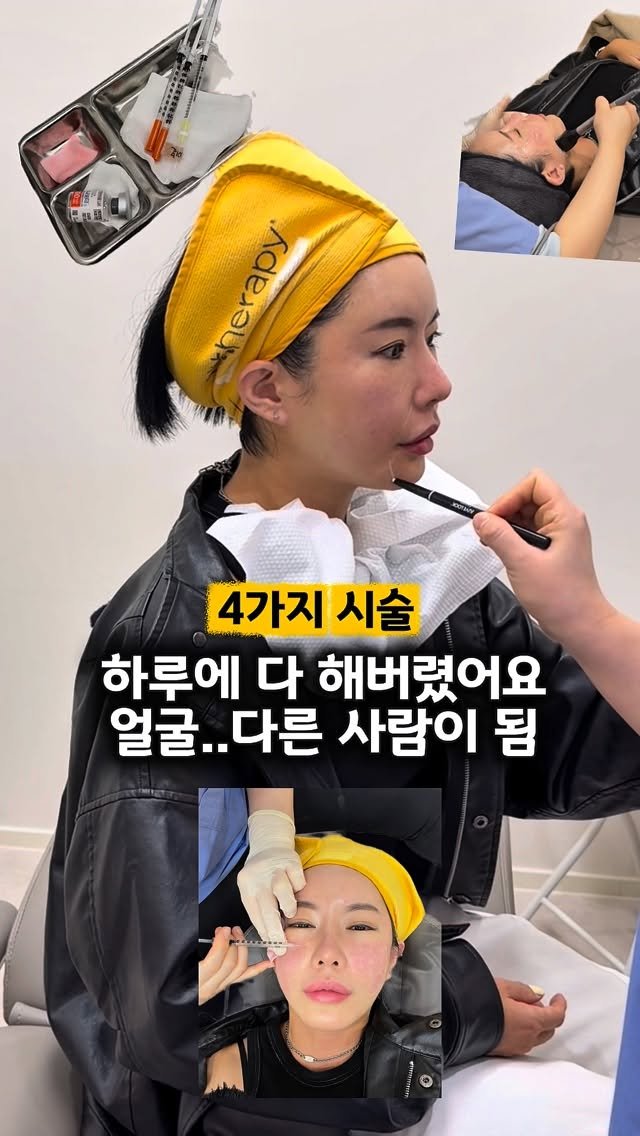 rudaya_nolja 게시물 이미지: 4가지 시술을 한번에 하는데 이가격??🫢

시술 한번 받고나면 다운타임...