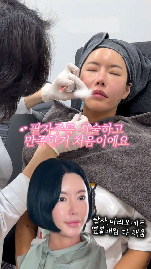 rudaya_nolja 게시물 이미지: 지금까지 받아 본 팔자주름
시술중에 최고예요🫢

최근에 팔자주름...