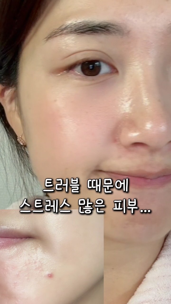 s2._seul 게시물 이미지: #광고 💛 트러블 때문에 속상했던 날, 이걸로 끝!

요즘 제가 진짜 애용하는...