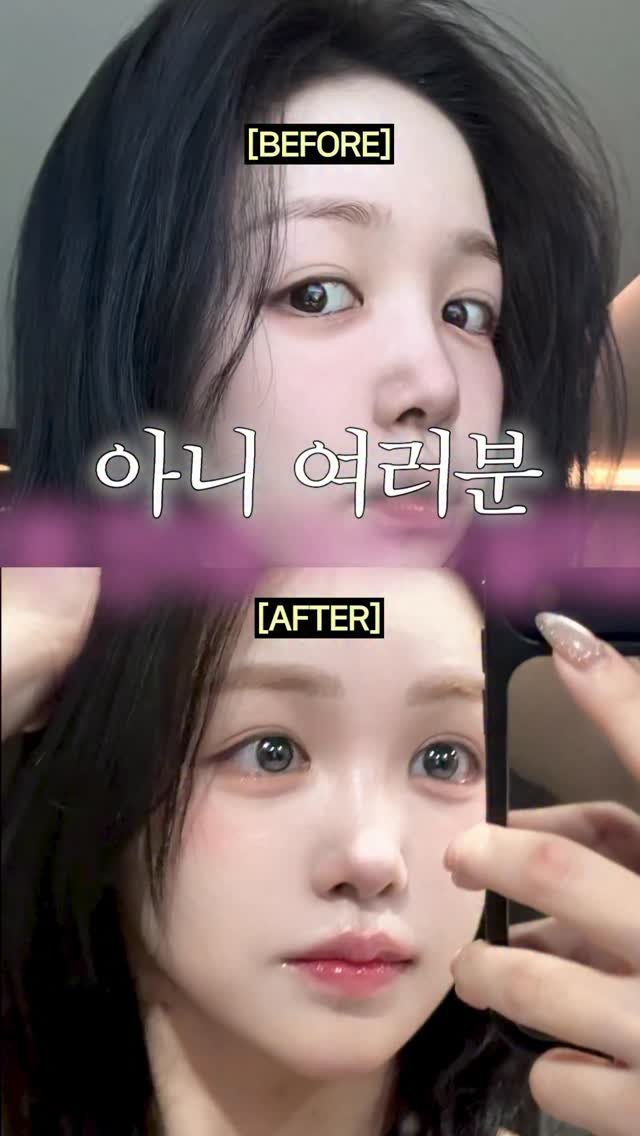 s_h_j_ 게시물 이미지: 🧊🥄 냉동실에 숟가락 얼려놓고 눈 붓기 빼본사람?
이제 숟가락 말고 세계최초 특허...