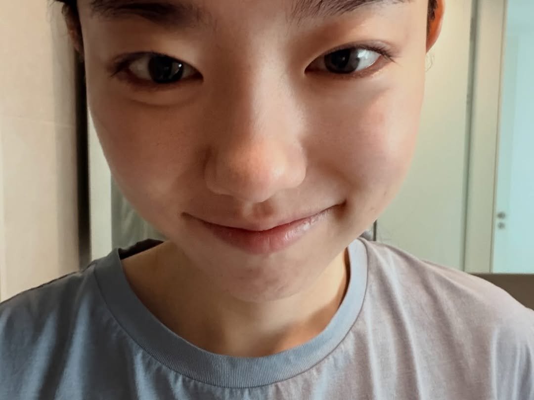 s_sohye 게시물 이미지: 사랑니 한 번에 세 개 뽑았습니다 치킨 먹고싶습니댜🍗