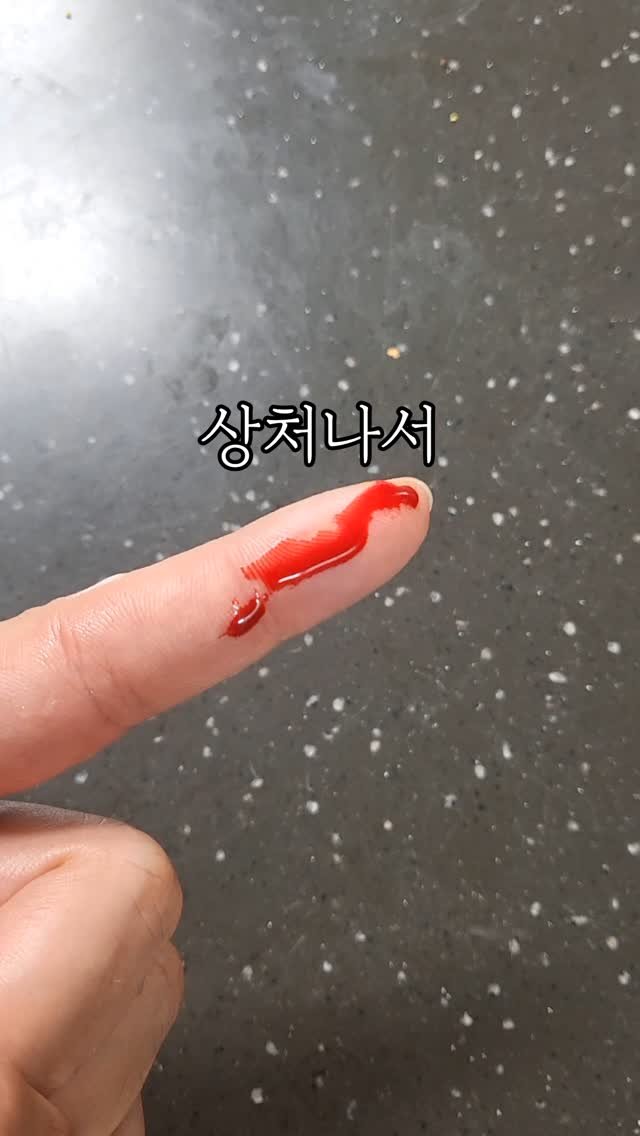 sallim_friend 게시물 이미지: ⭐️상처 났을 때 이거 붙이세요⭐️
✅해당 영상은 광고나 협찬을 받지않은
내돈내산...