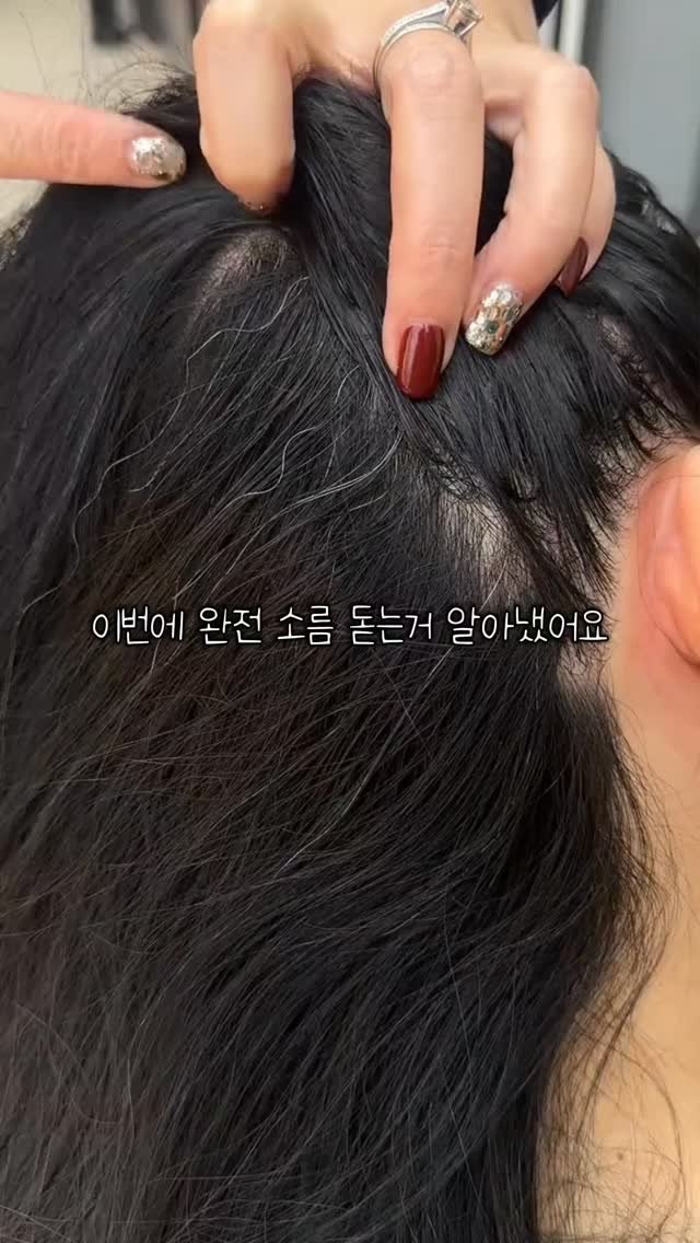 sallimmanage 게시물 이미지: 저는 어렸을때부터 새치때문에 스트레스가  많았어요…🥲

조명 아래 서면 가르마부터...