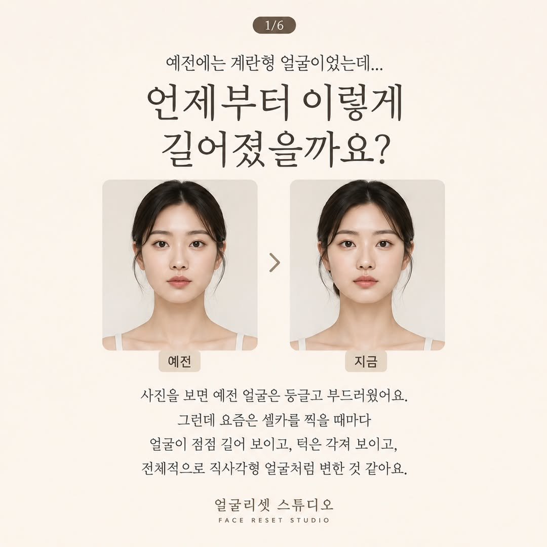 salondeyoung 게시물 이미지: 얼굴은 시간이 지나면서 무조건 길어지는 것이 아닙니다.
원인을 알면, 변화의 방향도...