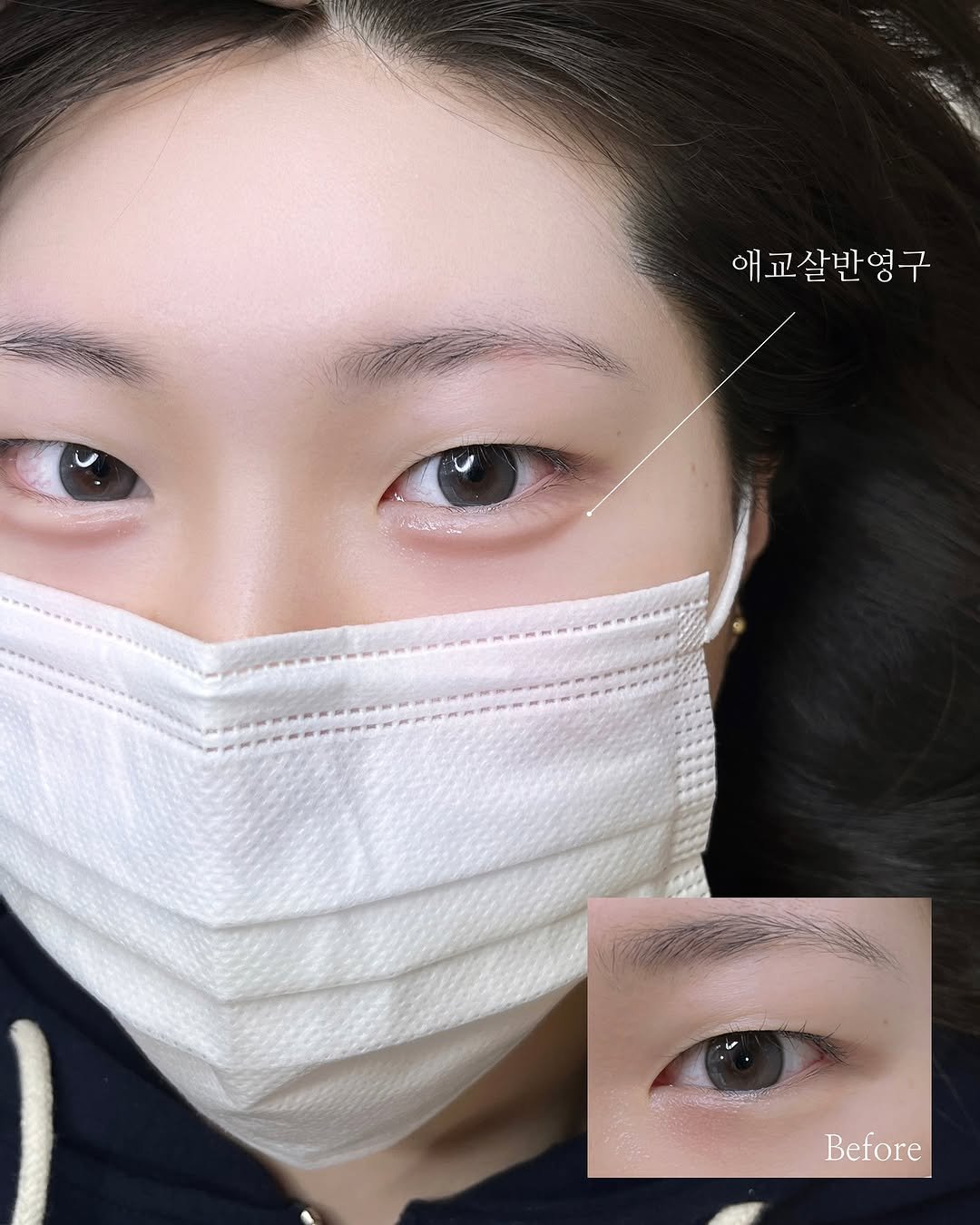 sand__brow 게시물 이미지: 중안부 짧아보이는 치트키 #애교살반영구

원래도 매력적인 무쌍 눈매의...