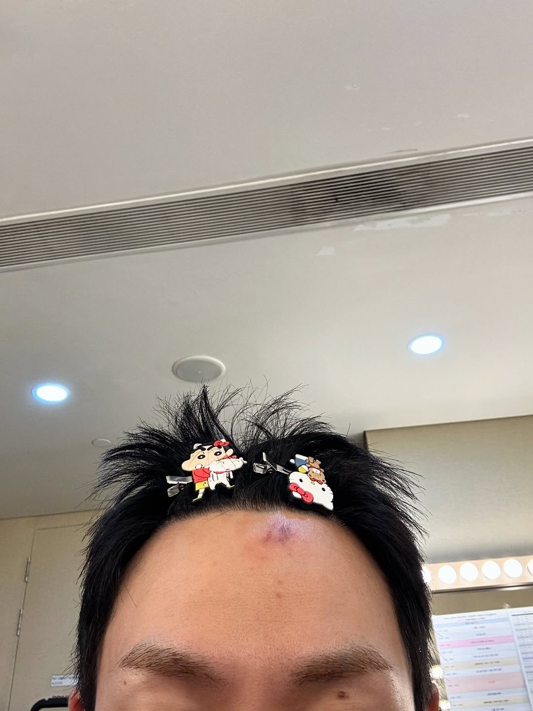 Photo by Loco | 로꼬 on November 20, 2025. May be a selfie of one or more people, hair, bandage and text.