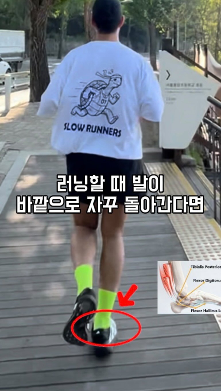 sb___kwon 게시물 이미지: ⭐️러닝할 때
한쪽 발이 유독 바깥으로 돌아가면서
발목이 불안정한 느낌 드는 분...