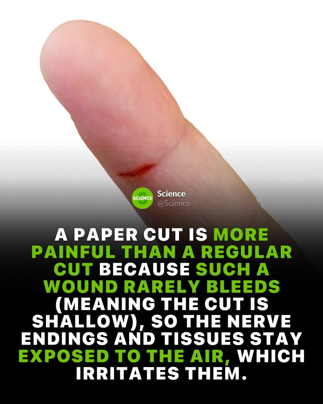 Photo by Science 🧬 on December 02, 2025. May be an image of bandage, plant and text that says 'SCIENCEScience SCIENCE Science @Scienc A PAPER CUT IS MORE PAINFUL THAN A REGULAR CUT BECAUSE SUCH A WOUND RARELY BLEEDS (MEANING THE CUT IS SHALLOW), so THE NERVE ENDINGS AND TISSUES STAY EXPOSED to THE AIR, WHICH IRRITATES THEM.'.