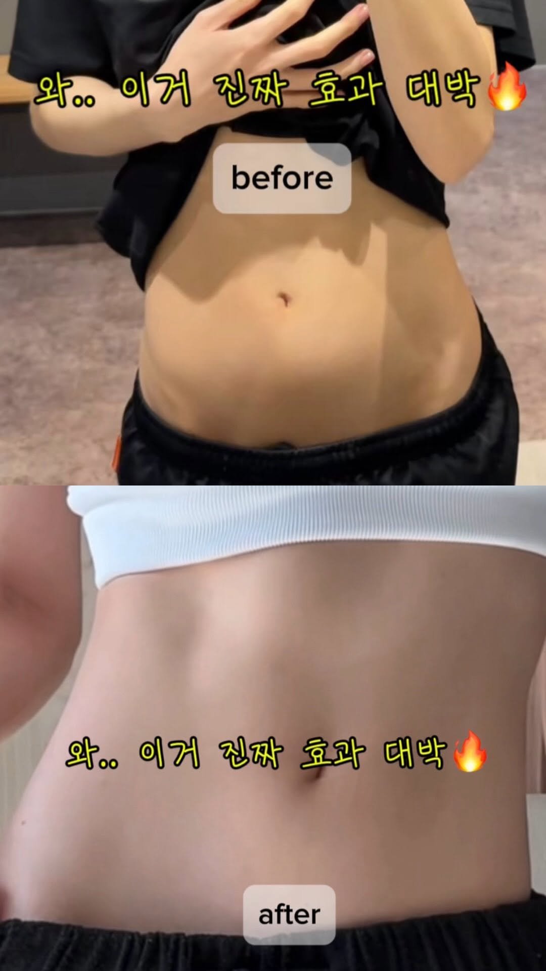 seulgi___h 게시물 이미지: 아랫배 처지고 옆구리 살 안 빠지는 사람들 꼭 보세요!!
저는 요즘 이걸로 틈틈이...