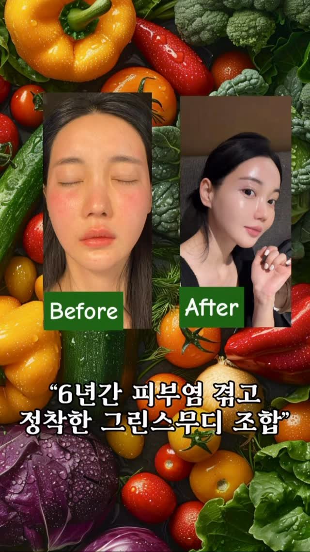 seung_muse 게시물 이미지: 피부염으로 6년을 보내면서
정말 많은 방법을 시도했어요💡

그러다 결국 남은...