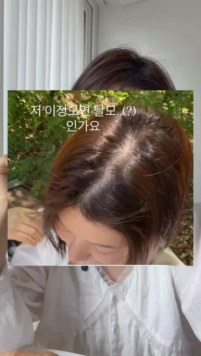 shany__day_ 게시물 이미지: 저 얼마 전에 스토리에 탈모냐고 물어봤는데
반 이상이 탈모 같다고...
