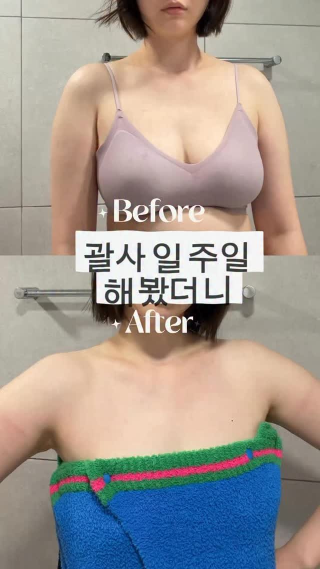 shany__day_ 게시물 이미지: #공구중아녹바디케어 괄사 일주일 후기! 

제가 지난번에
“날씬한 사람들만 괄사하는...