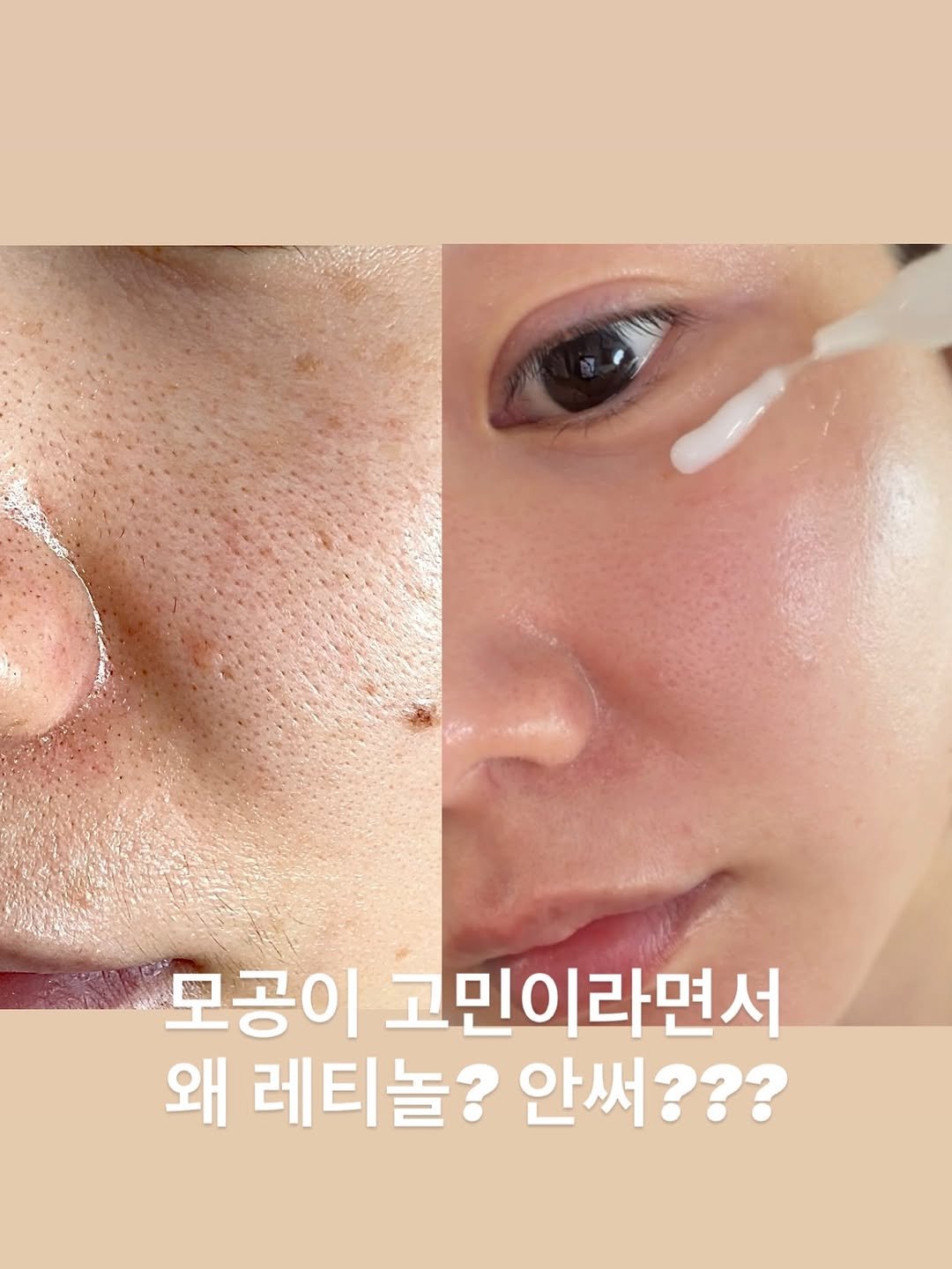 shany__day_ 게시물 이미지: #내일마감클리어디어 모공 때문에 이것저것 써봤는데
결국 느낀건… 모공은...