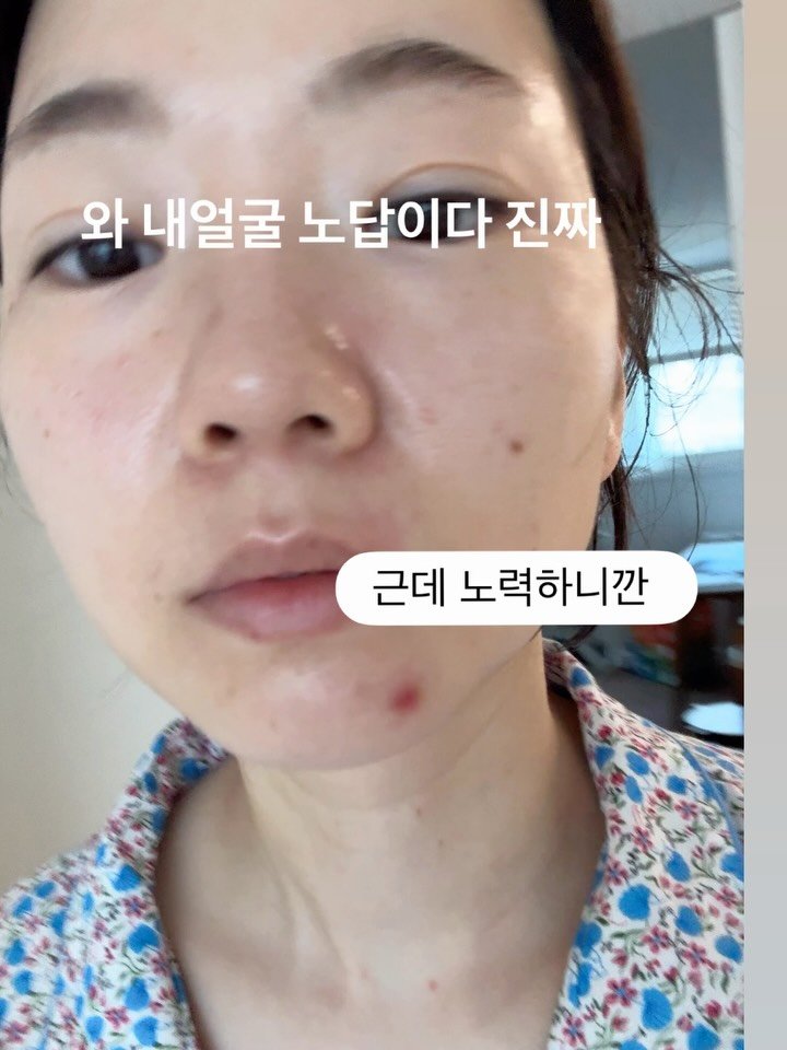 shany_diet 게시물 이미지: #공구중 클리어디어 나이트 루틴 피부가 노답일 땐 몰랐어요..😅

작년까지만 해도...