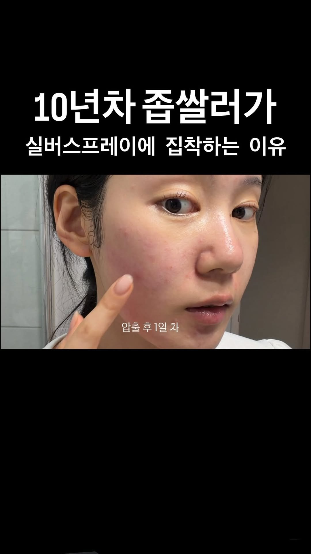 sharon_0817_ 게시물 이미지: 정말 좁쌀 인생 최고의 인생템..
여러분 꼭 집중케어 루틴으로 써보셔야...