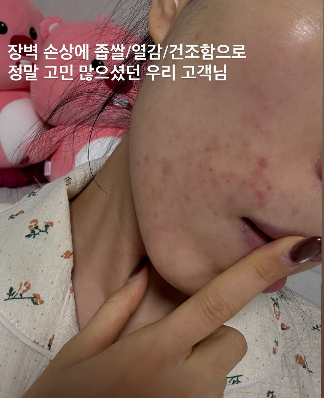 sharon_0817_ 게시물 이미지: #실버스프레이오픈 #다음입고8월 
최소 3-6개는 든든하게...