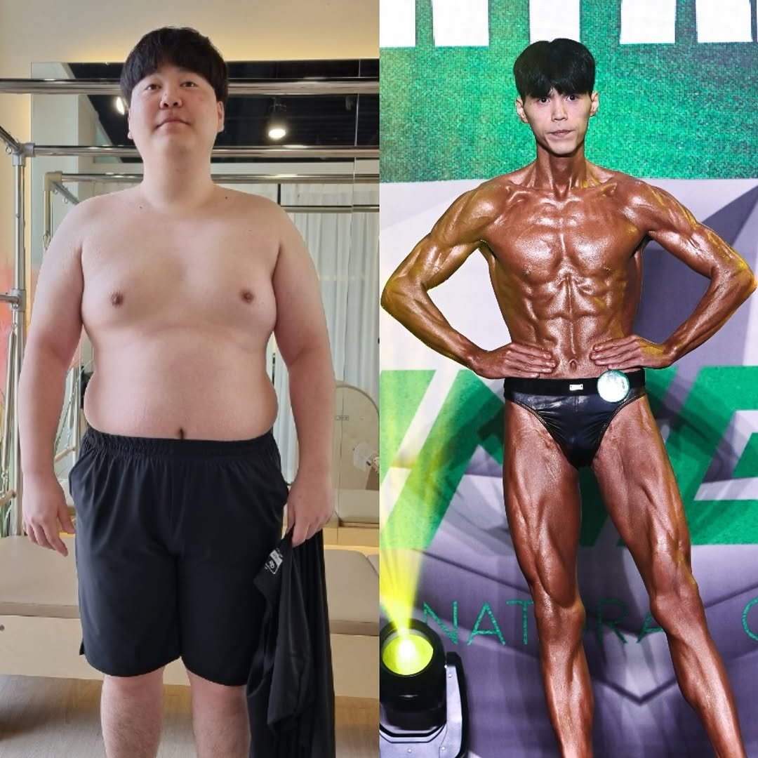 shyunfit 게시물 이미지: 120.7kg👉62.3kg

비가오나 눈이오나 한결같은 
꾸준함으로 일궈낸...