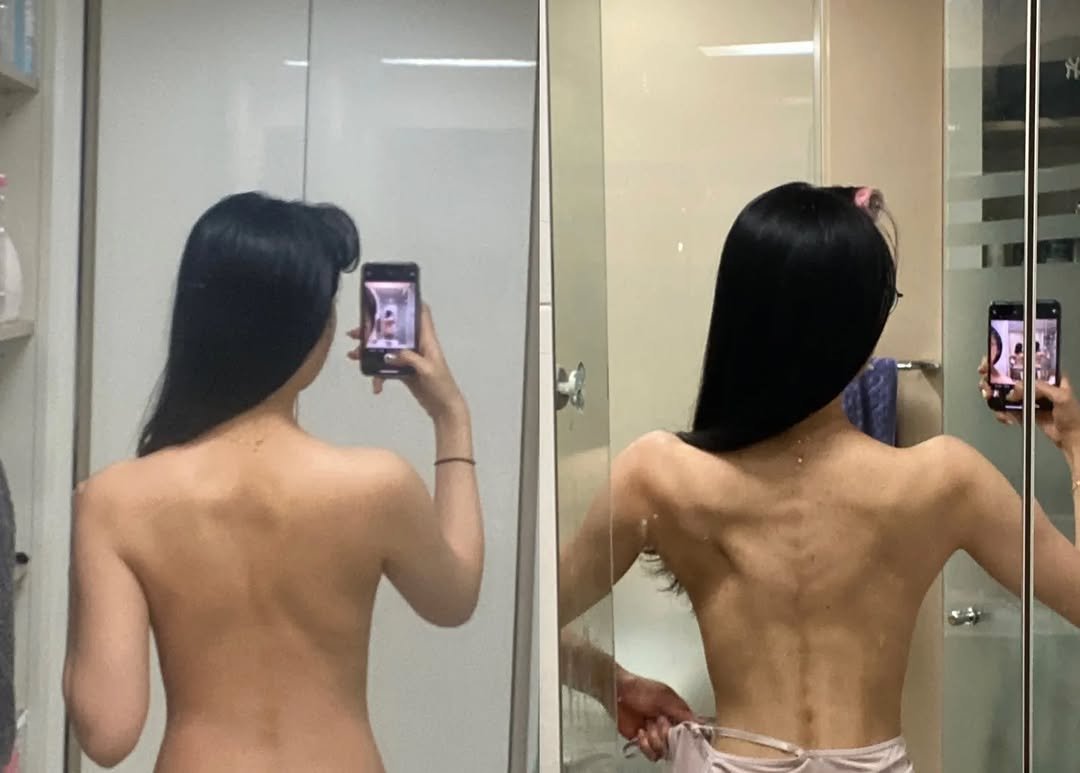 shyunfit 게시물 이미지: 슬라임에서 마른장작으로
#비포에프터
