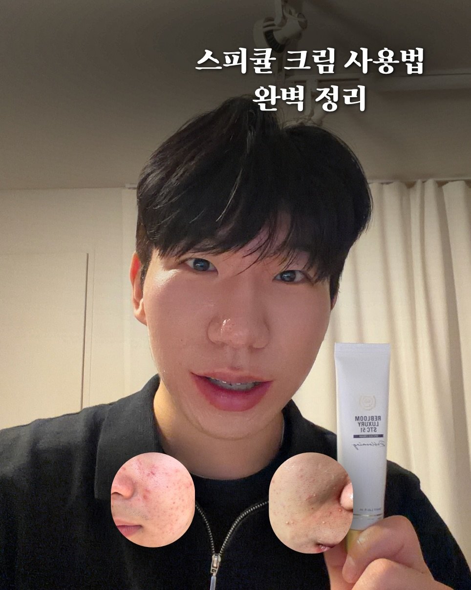 skin_mst 게시물 이미지: 📣(중요) 스피큘 크림 사용법 

📌이런 분들이 사용하면 좋아요 
1.모낭염 우수수...