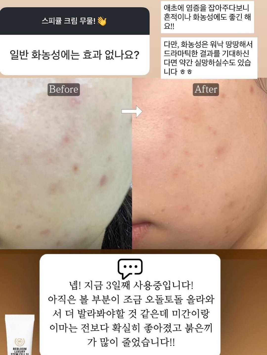 skin_mst 게시물 이미지: 드디어 내일! 오픈입니다! 

06.22(월) ~ 06.26(금) 총 5일간...