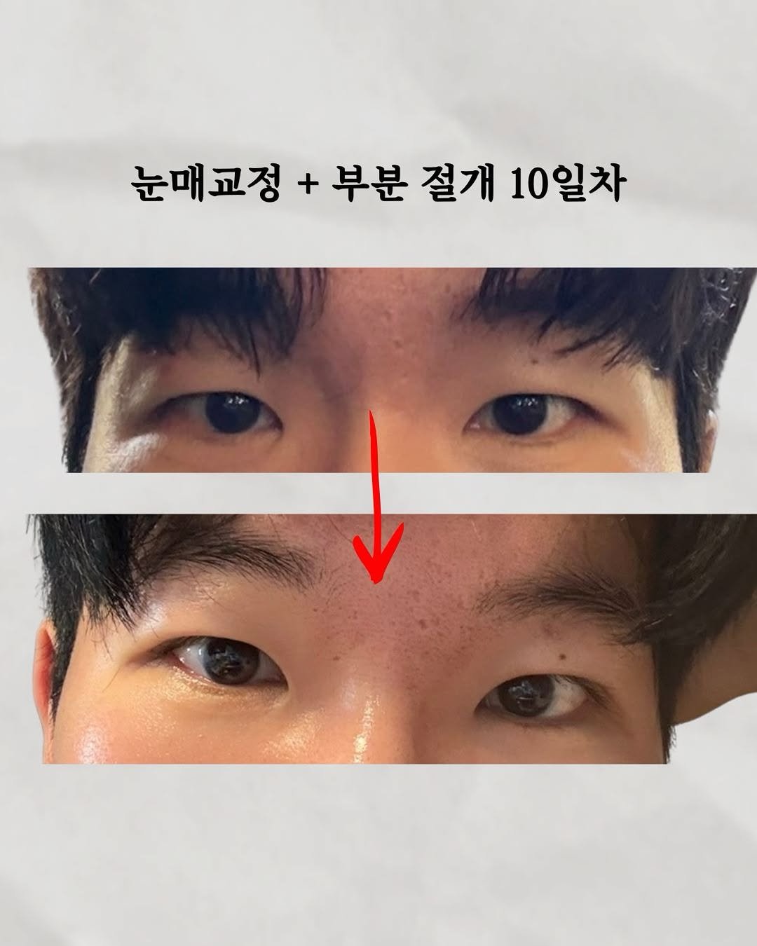 skin_mst 게시물 이미지: 잘 된것 같나요?? ㅎㅎ