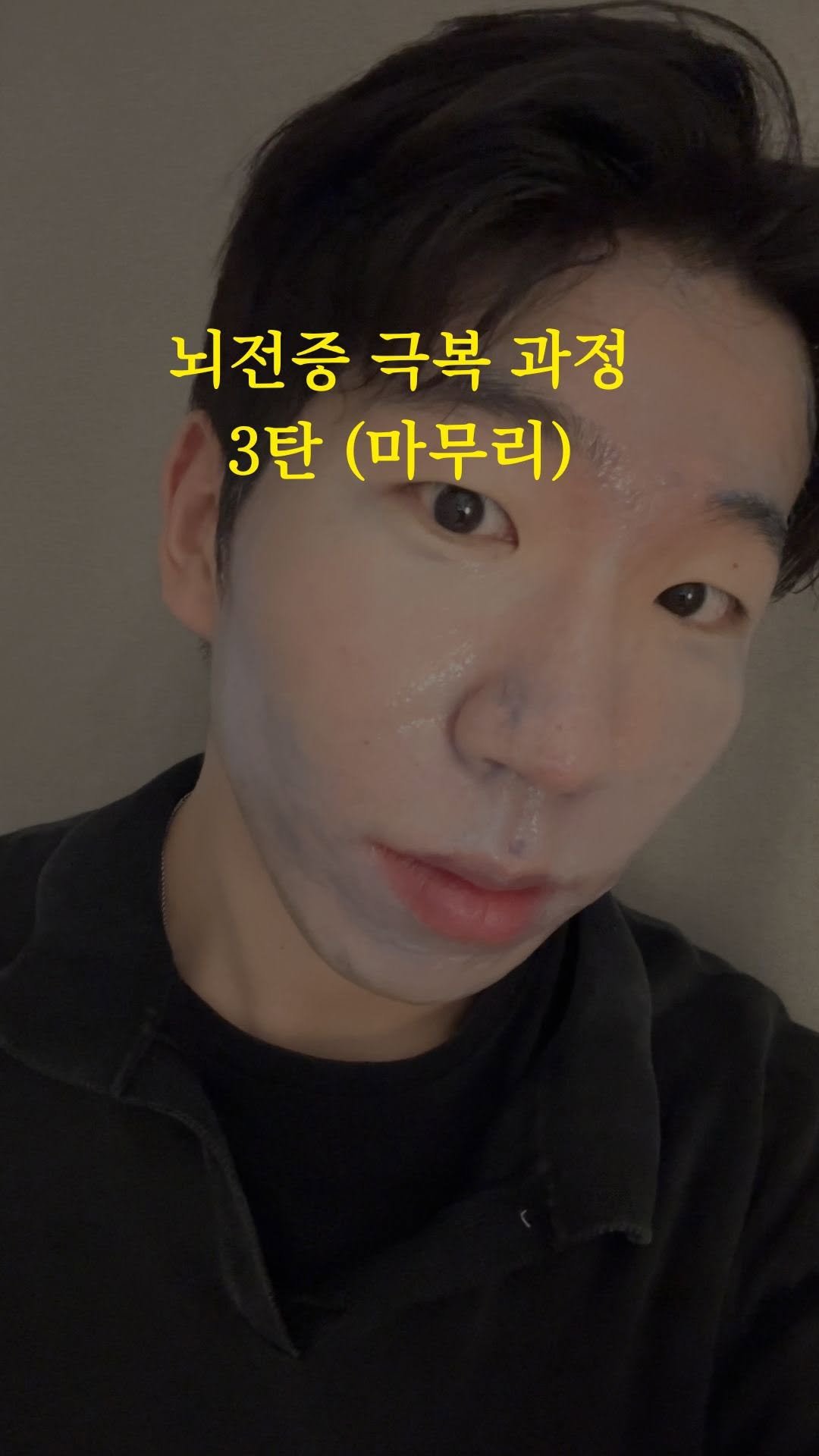 skin_mst 게시물 이미지: 뇌전증 마무리 화입니다! 
 

이렇게까지 저의 사적인 이야기를 풀어봤던 적은...
