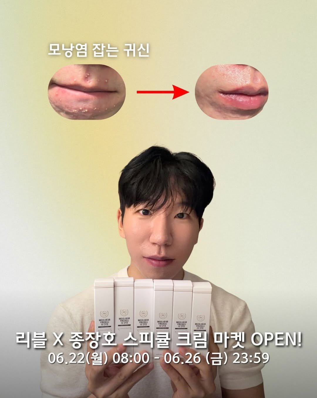 skin_mst 게시물 이미지: 여러분!! 🥹모낭염 초고속 진정 스피큘 크림 드디어 오픈합니다.. 

제가...