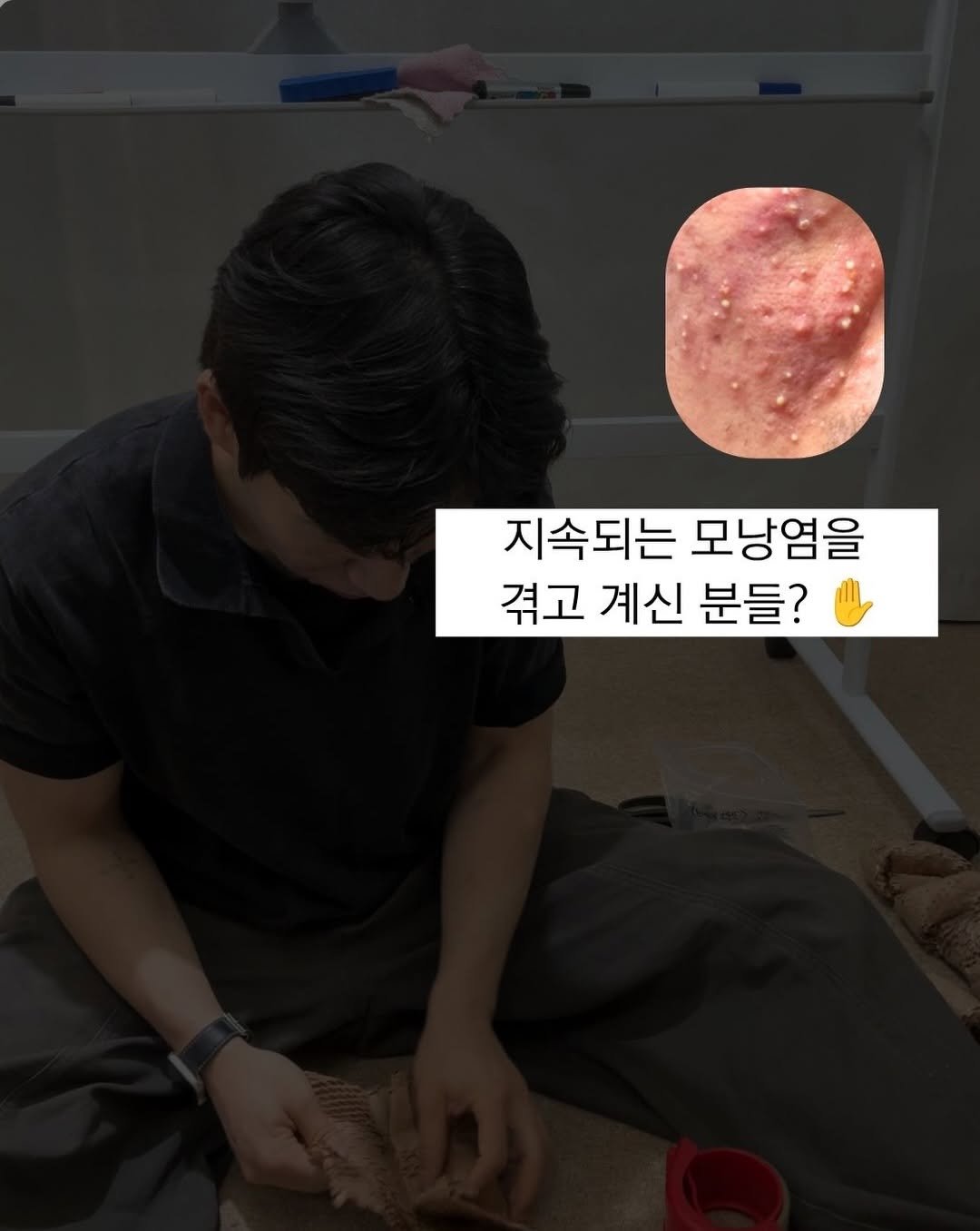skin_mst 게시물 이미지: 🎁모낭염 잡는 스피큘 크림 (필크림) 체험단 모집! 

📝지원 자격 
1.반복되는...