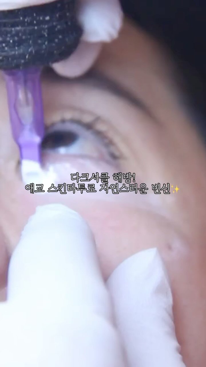skinbeauty__101 게시물 이미지: [한 방에 환해지는 다크서클 & 애교 스킨타투✨]

💡 지친 눈 밑, 어두운...