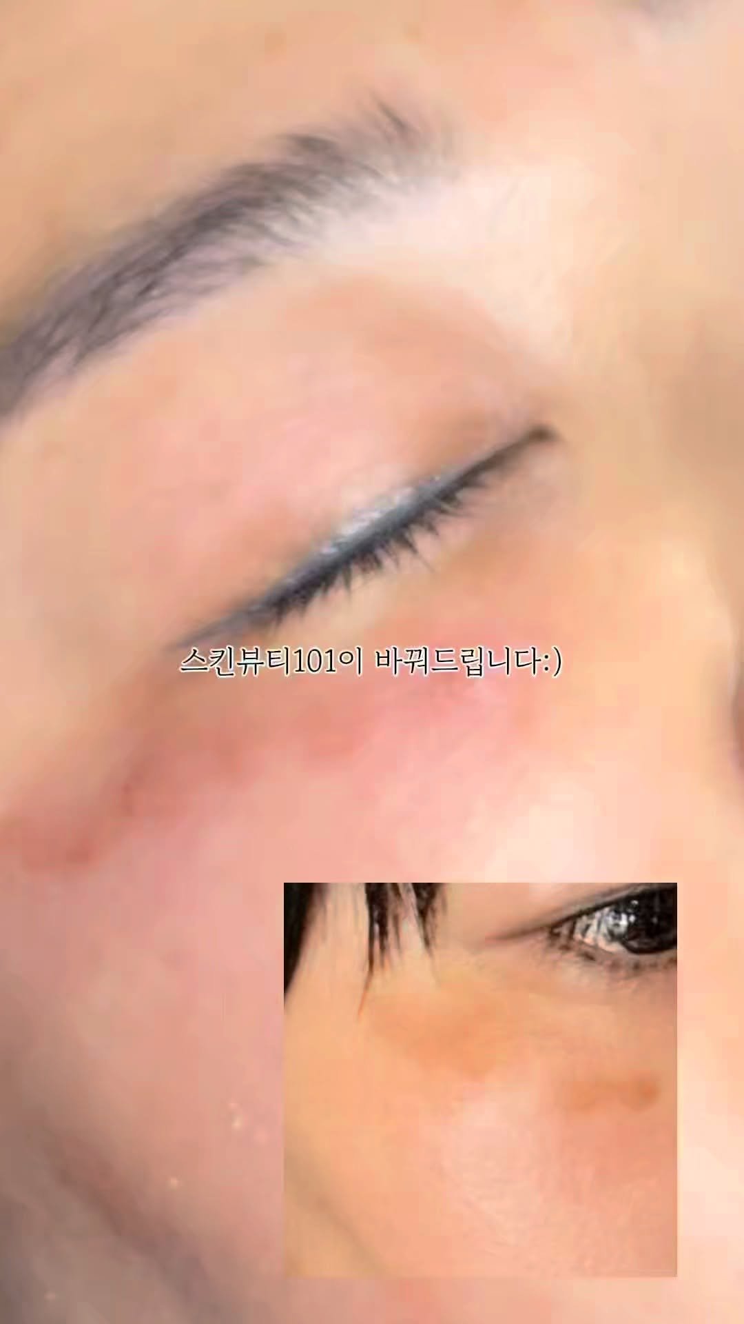 skinbeauty__101 게시물 이미지: 🌤 자외선, 호르몬 변화, 임신, 스트레스…

언제부턴가 얼굴에 번져버린...