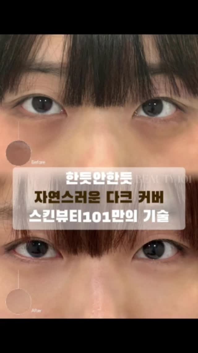 skinbeauty__101 게시물 이미지: 이렇게 자연스러운 커버 보신 적 있나요?

스킨타투는 단순히 색을 덮는 게...