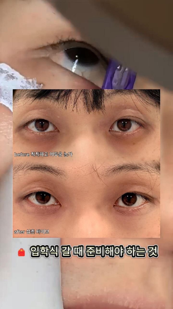 skinbeauty__101 게시물 이미지: 😴 피곤한 아빠 → ✨삼촌 바이브 변신!

✔️ 늘어나는 다크서클
✔️ 잠 못...