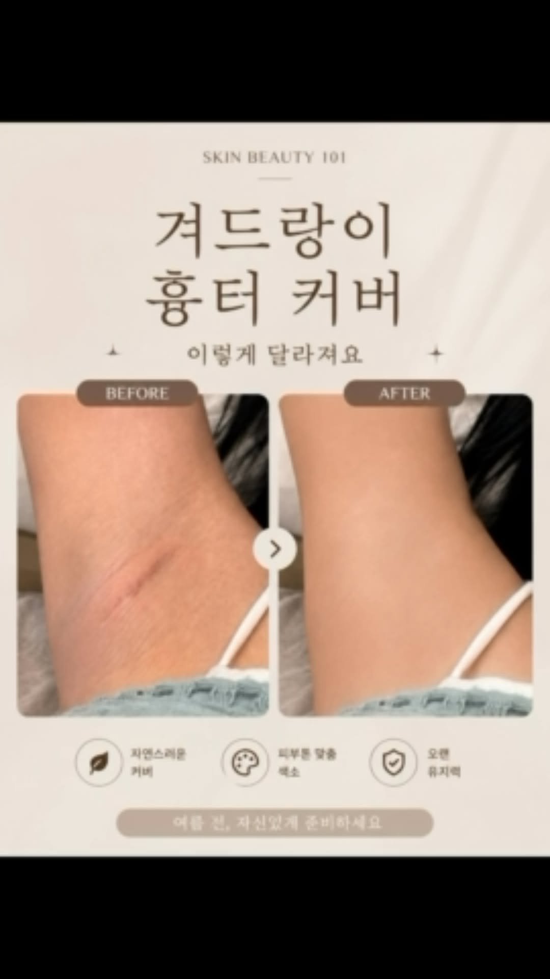 skinbeauty__101 게시물 이미지: ”이 흉터도 커버될까요?“

최근 DM 문의 중 가장 많은 문의가
바로 겨드랑이...