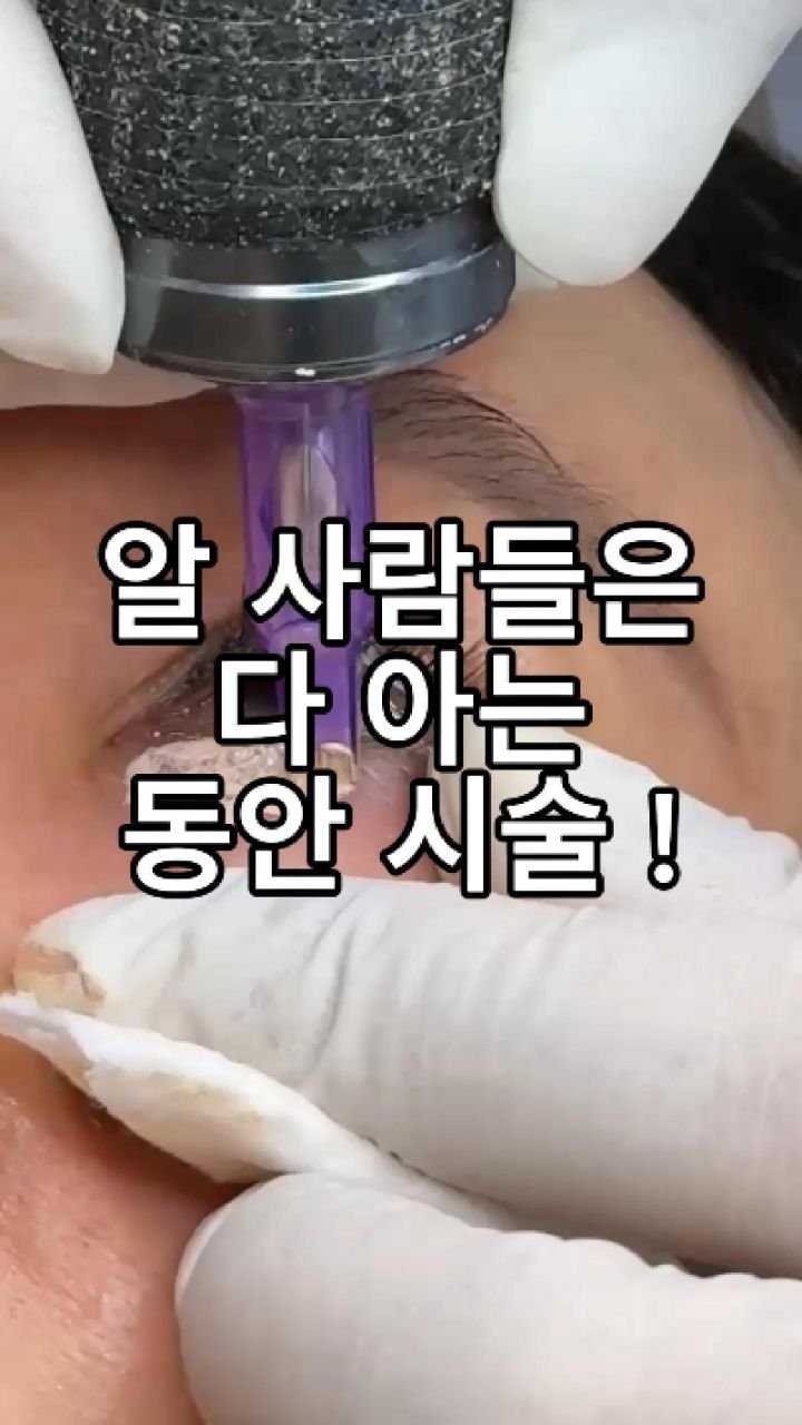 skinbeauty__101 게시물 이미지: 알 사람들은 다 아는 그 시술 👀

영상 속 알림음,
다 우연 아니에요...
