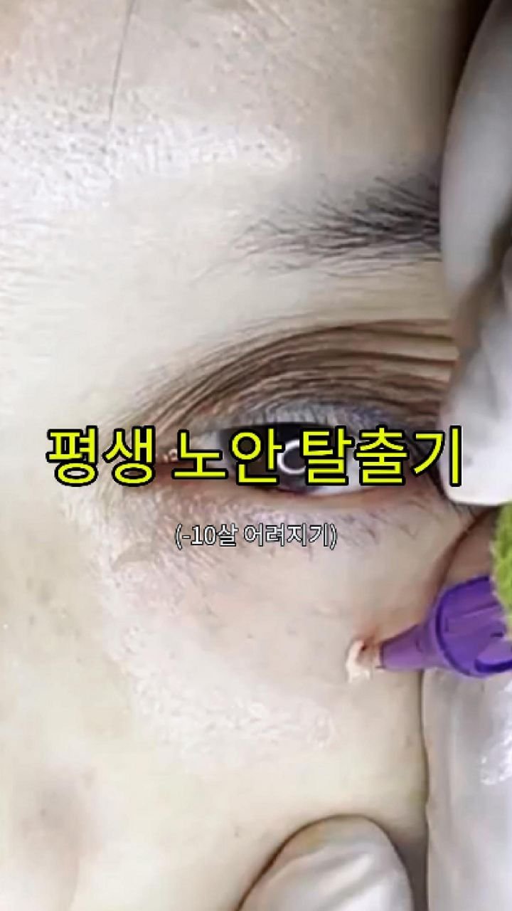 skinbeauty__101 게시물 이미지: ✨ 평생 노안 탈출, 다크서클 반영구 ✨
칙칙한 눈가 때문에 항상 피곤해...